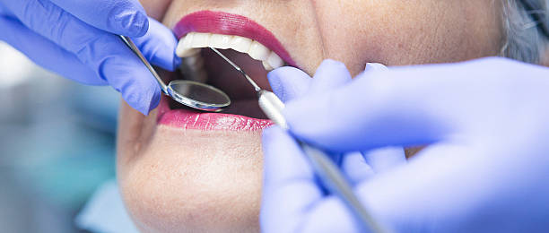 Best Broken or Cracked Tooth Emergency Dentist in Adrian, MI